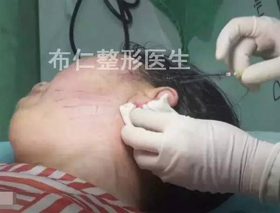 步骤图解10