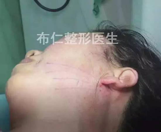 步骤图解12