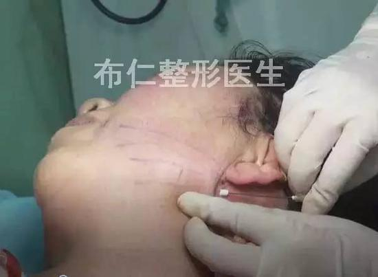 步骤图解9