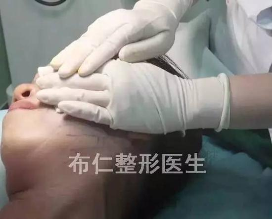 步骤图解4