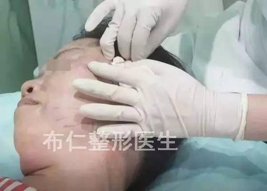 步骤图解2