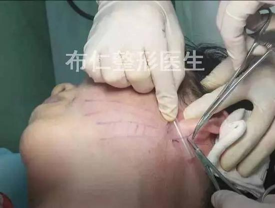 步骤图解11