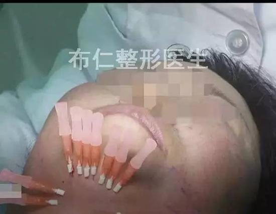 步骤图解14