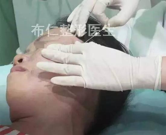步骤图解3