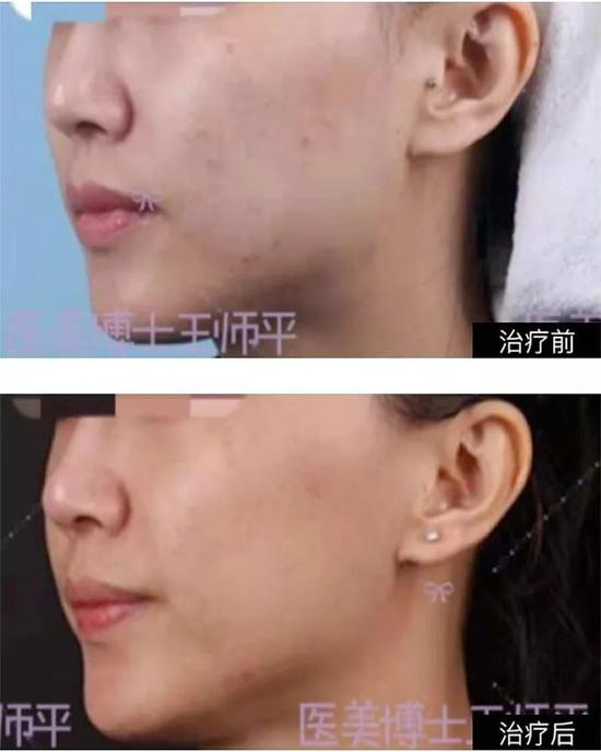 王师平案例