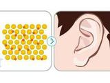 玻尿酸填充耳垂效果好吗 打完玻尿酸后要注意什么