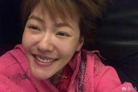 小S做医美后大方晒自拍 脸部略肿胀笑容仍灿烂