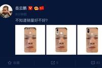 岳云鹏面膜照被做成手机壳 本尊却关心销量如何