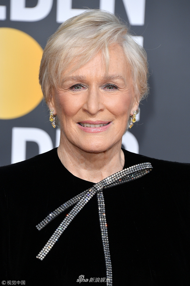 格伦·克洛斯打败妮可·基德曼gaga 获金球奖剧情类影后