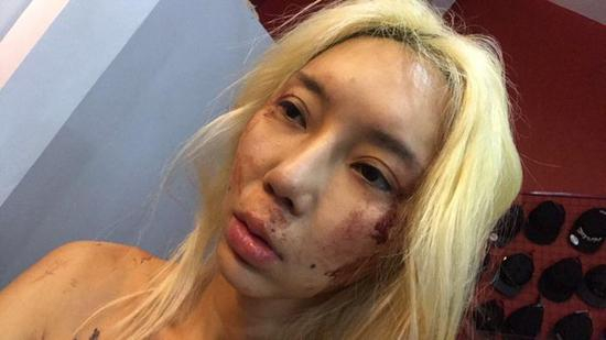 林云这几年来不断被暴打，她透露无法报警是因为男友在警界颇有人脉