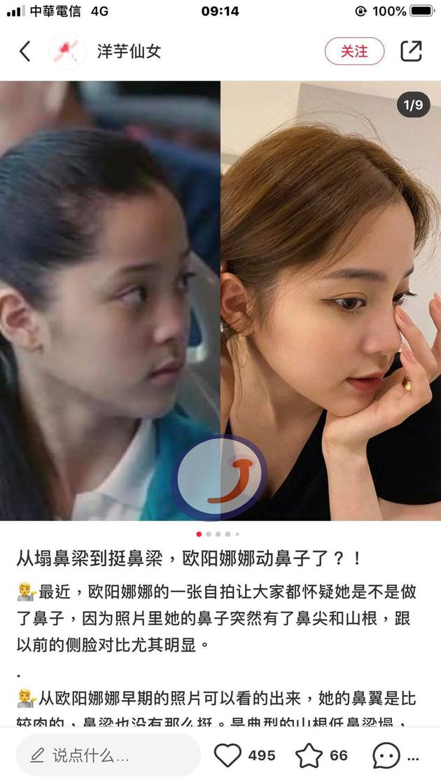 &nbsp;欧阳娜娜被指整容