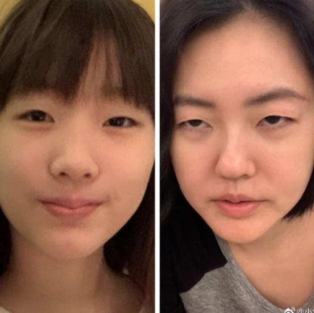 小S晒与女儿单眼皮照