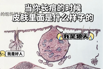 爆痘