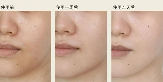 （使用效果因人而异） 　　图源本账号，转载需注明（下同）