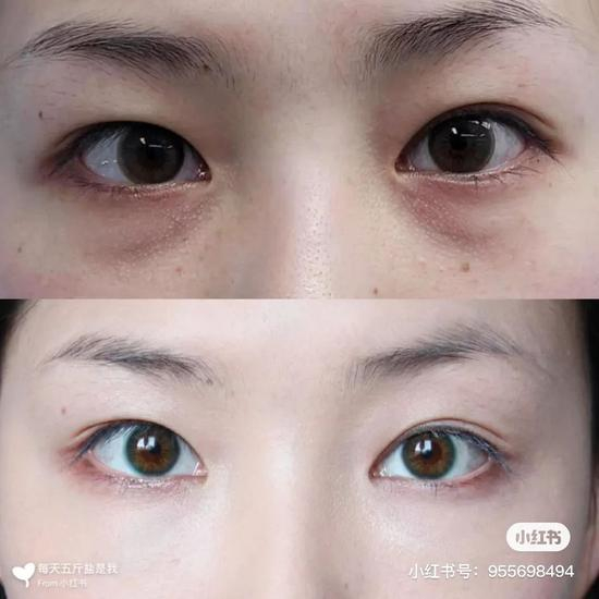 图源：小红书@每天五斤盐是我