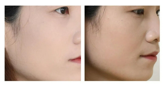 （cr。本账号。转载请注明来源。使用效果因人而异）