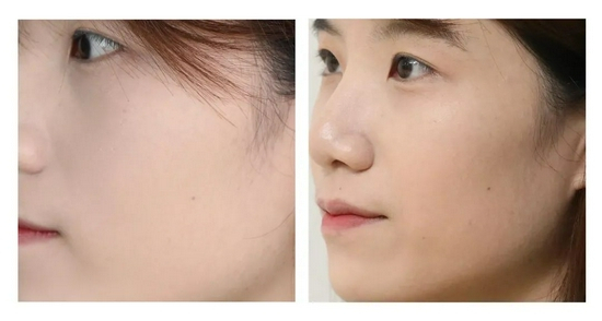 （cr。本账号。转载请注明来源。使用效果因人而异）