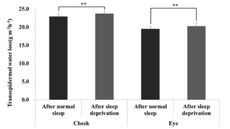 图源参考文献[2]