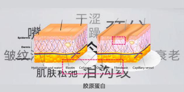 　图2 胶原蛋白与肌肤衰老机制的重要关系