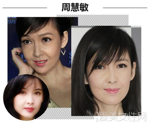周慧敏