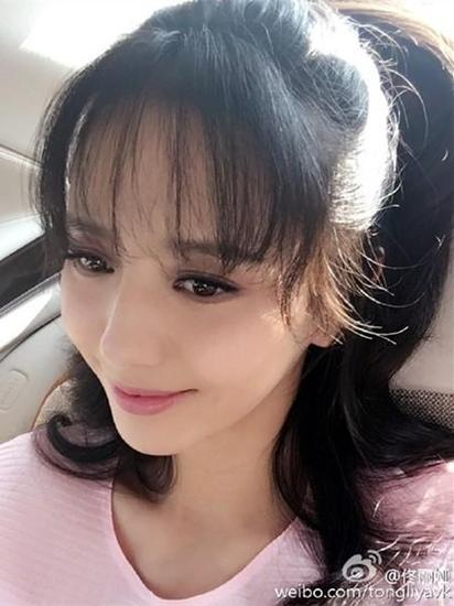 发际线后移，移出一片艳阳天