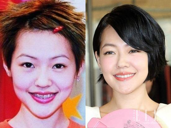 小S