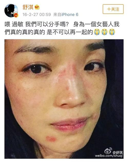 舒淇 换季秒变敏感肌