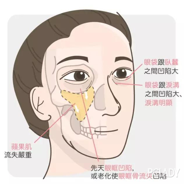 示意图