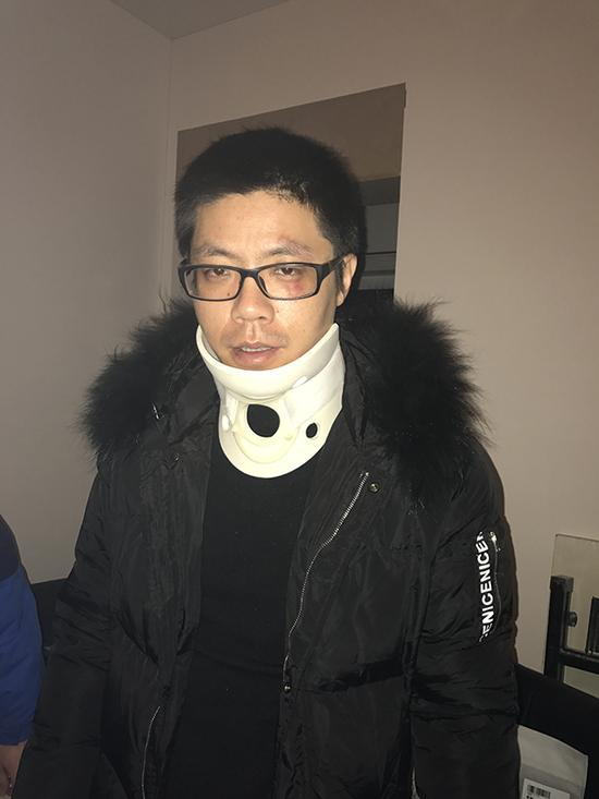 曹先生说，在与城管的冲突中，他的颈椎和脸部受伤。 澎湃新闻记者 邱海鸿 图