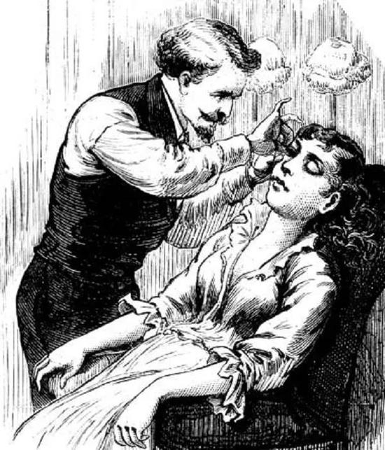  19世纪假睫毛嫁接手术。