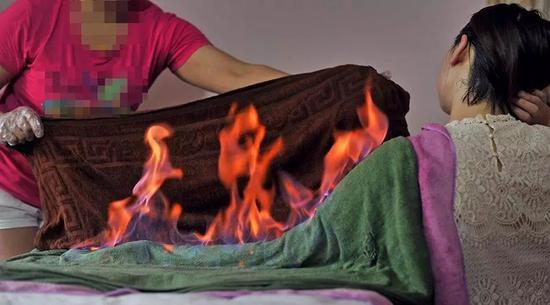 权健火疗店，一位店员正在给客人做火疗&nbsp;&nbsp;。图片来源：经拍摄者授权