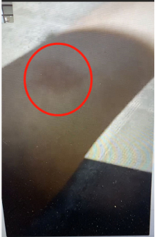 袁小虎向记者展示左前臂被打伤的痕迹 