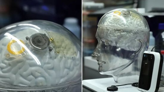  “北脑一号”如硬币一般大小