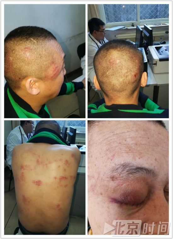 刘悦的大舅被打之后（刘悦供图）