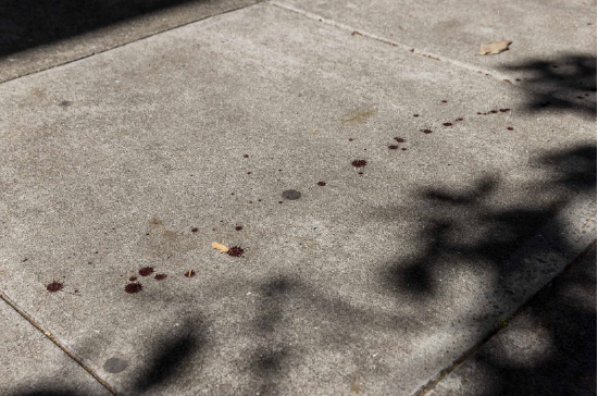 （鲍勃李的血残留在旧金山街头，周二拍摄）