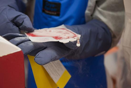 　　患者的细胞。在CAR-T治疗中，患者的T细胞（免疫细胞）在实验室中，经基因改造，用于识别和杀死肿瘤细胞。