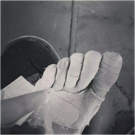 &nbsp;赛程中每天在露营地需要处理自己的双脚比如用针头钻开指甲盖挤出下面水泡的压力