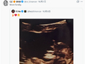 何一晒女儿B超照片，赵长鹏转发配文“More family”