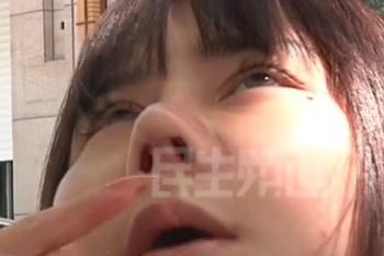 女子隆鼻术后变匹诺曹