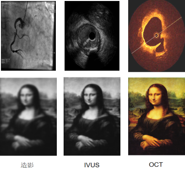 心血管领域常用成像技术效果对比