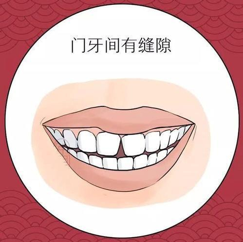 通过牙齿观人运，论其命，何门牙有缝的人存不住钱？