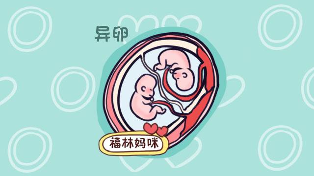 生了一对同卵双胞胎是啥体验?宝妈:总怀疑自己把俩孩子弄混了