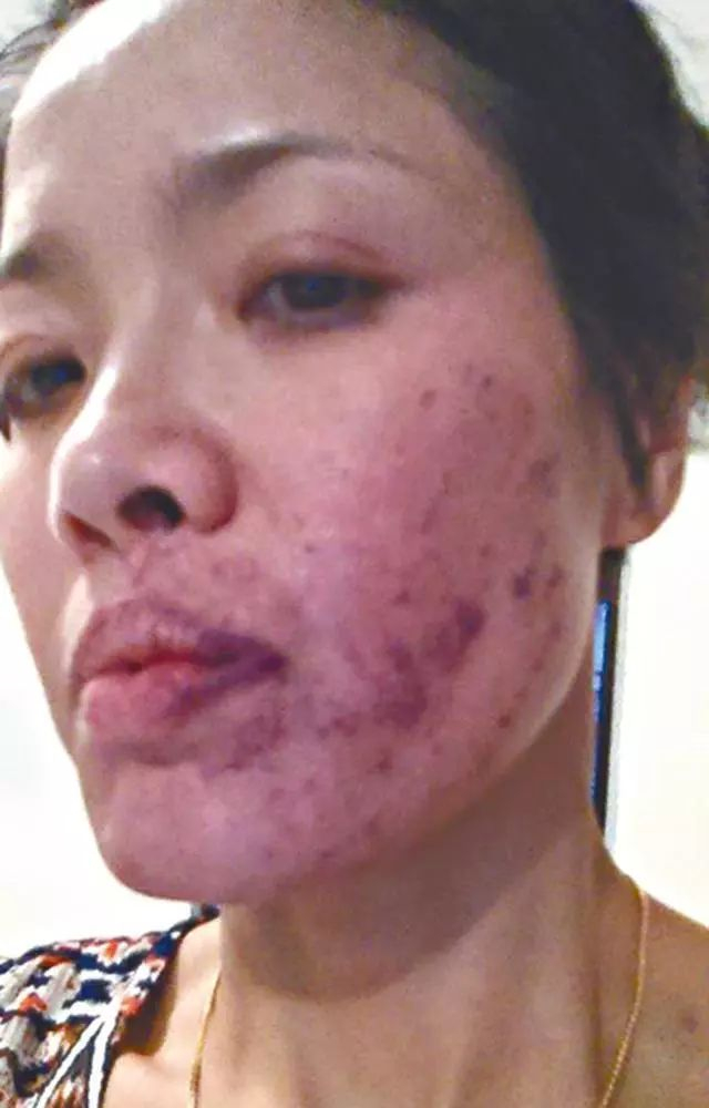 曾经历毁容导致意志消沉 如今54岁为TVB拍剧怀揣感恩之心|TVB|肥猫正传_新浪娱乐_新浪新闻