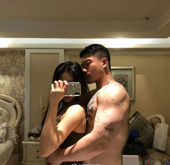 第二 肌肉维度的差别