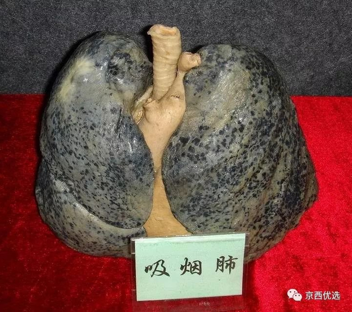 “吸烟”也健康！好抽不伤身体的替烟神器，日本狂销400万支！