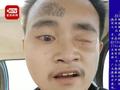 左眼残疾、额头颈部有纹身!史上最容易辨认通缉犯落网
