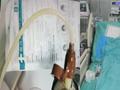 男子经常啤酒加烧烤 体重不涨反降了20斤 一查血液竟变成乳白色