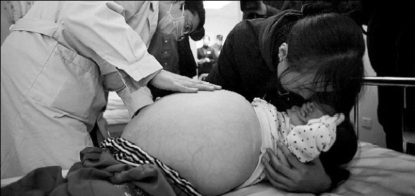 在医生检查时，小星用手遮住自己的脸，不愿拍照，妈妈不停地安慰着病床上的她