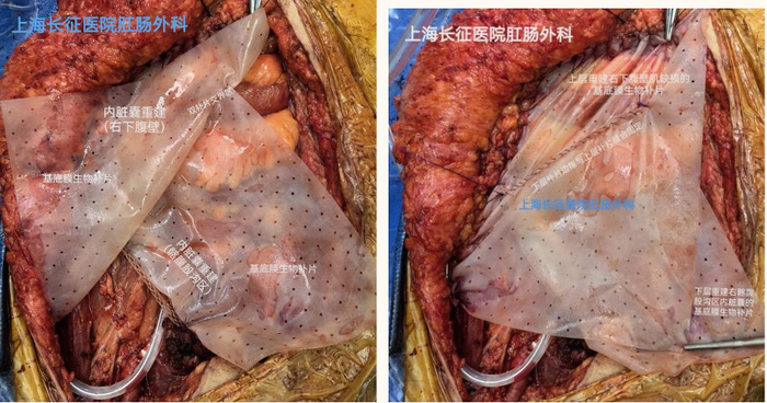 这一次,和退伍老兵并肩战斗!