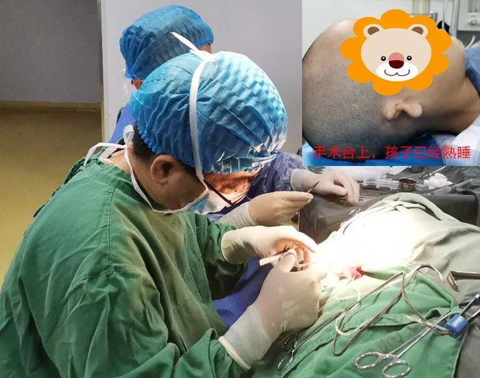 小耳畸形手术少年长大了,如今实现更多孩子双耳梦|手术|耳朵|外耳
